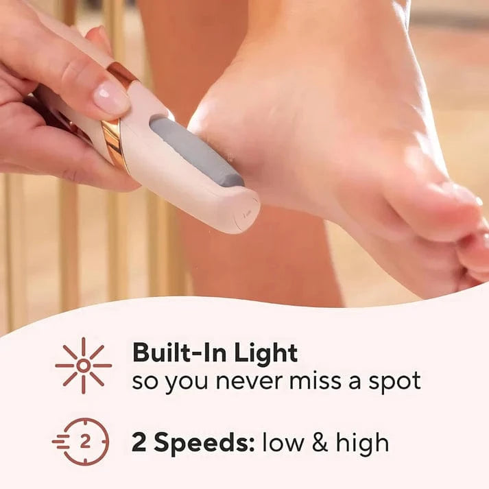 🦶 Callus Remover by QuickTech