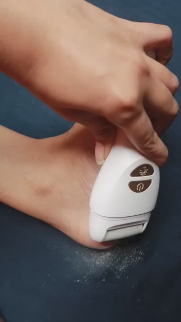 🦶 Electric Callus Remover by QuickTech